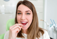 The Surprising Benefits of Invisalign for Jaw Alignment